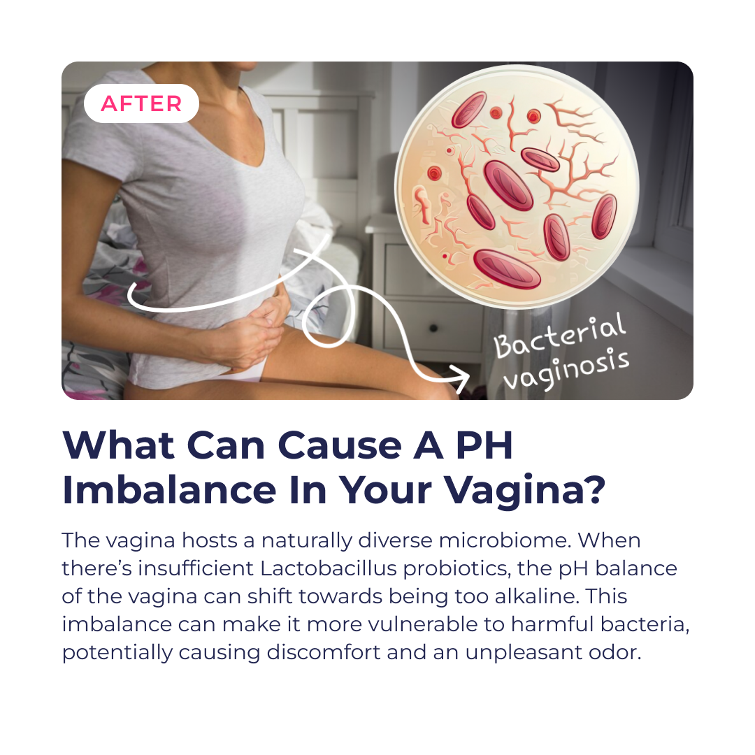 Feminine Flora Probiotic Daily Support